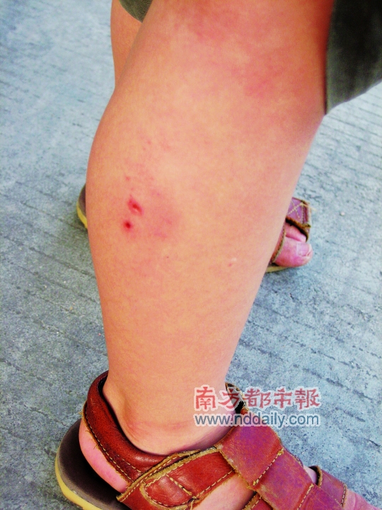 女子称献爱心养数十流浪狗 屡次咬伤邻居或受罚