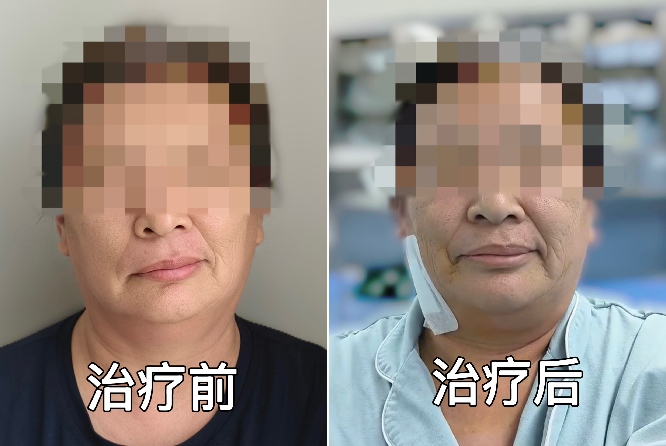 3f8881a79b4aab60c915d6395e795c1a