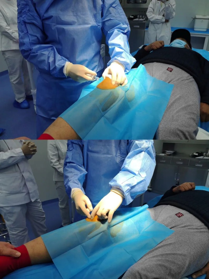 喜报首例？脐带间充质干细胞注射液治疗膝关节骨性关节炎细胞治疗技术成功落地乐杰 图3